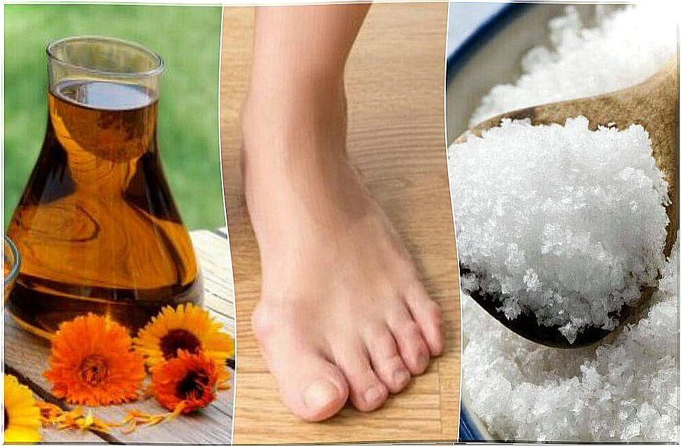 4 natural remedies for hallux valgus