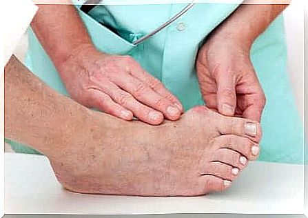 Person with hallux valgus