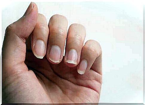 Four natural ingredients to treat brittle nails