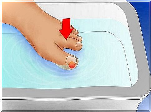 How to treat ingrown toenails