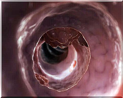 the diverticulum