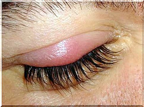 Natural treatments for eye trail